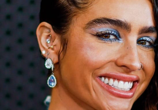 sommer ray teeth in 2024