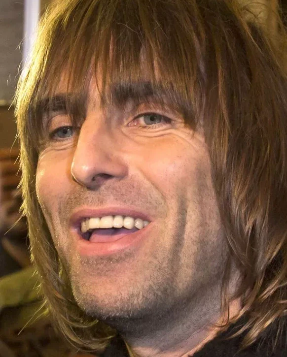 liam gallagher tanden