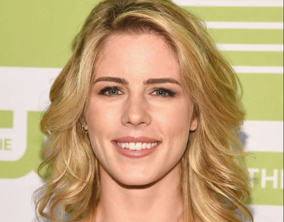 emily-bett-rickards-teeth-in-2015