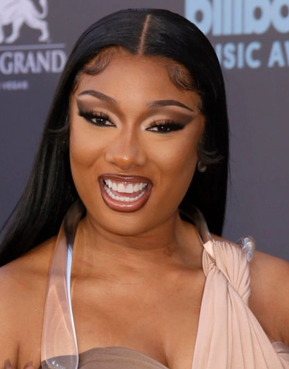 Megan Thee Stallion Zähne 2022