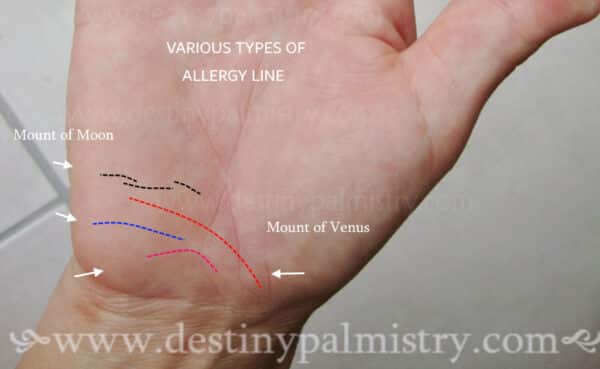 types of allergy lines