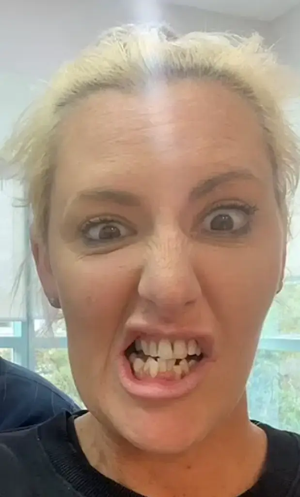 jess eva teeth 2018