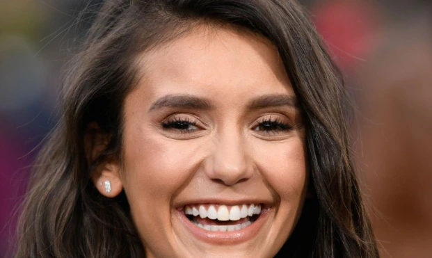 denti di nina dobrev nel 2018