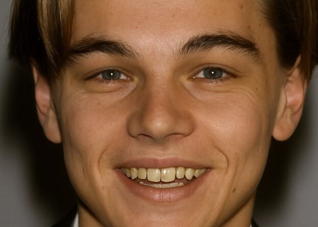 leonardo dicaprio dientes en 1990