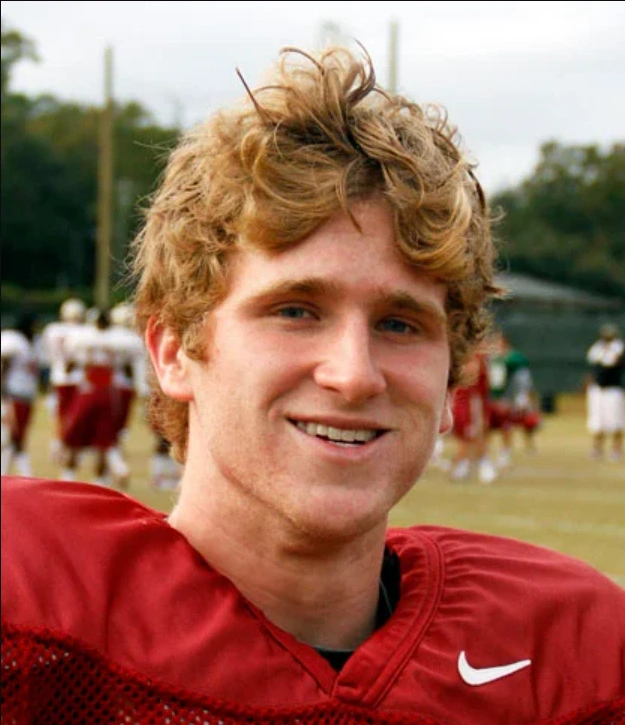 dustin hopkins dientes antes
