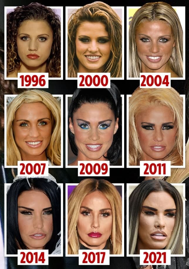 katie-price-new-dental-2-min