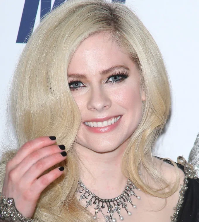 avril lavigne teeth in 2017
