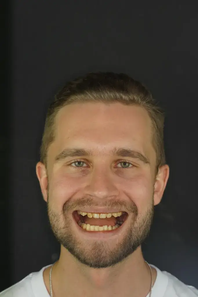 artūrs valdmanis dantys 2025