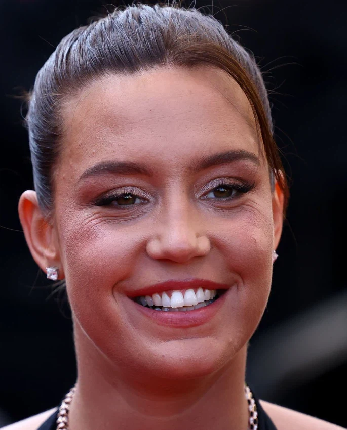 adèle exarchopoulos teeth in 2024