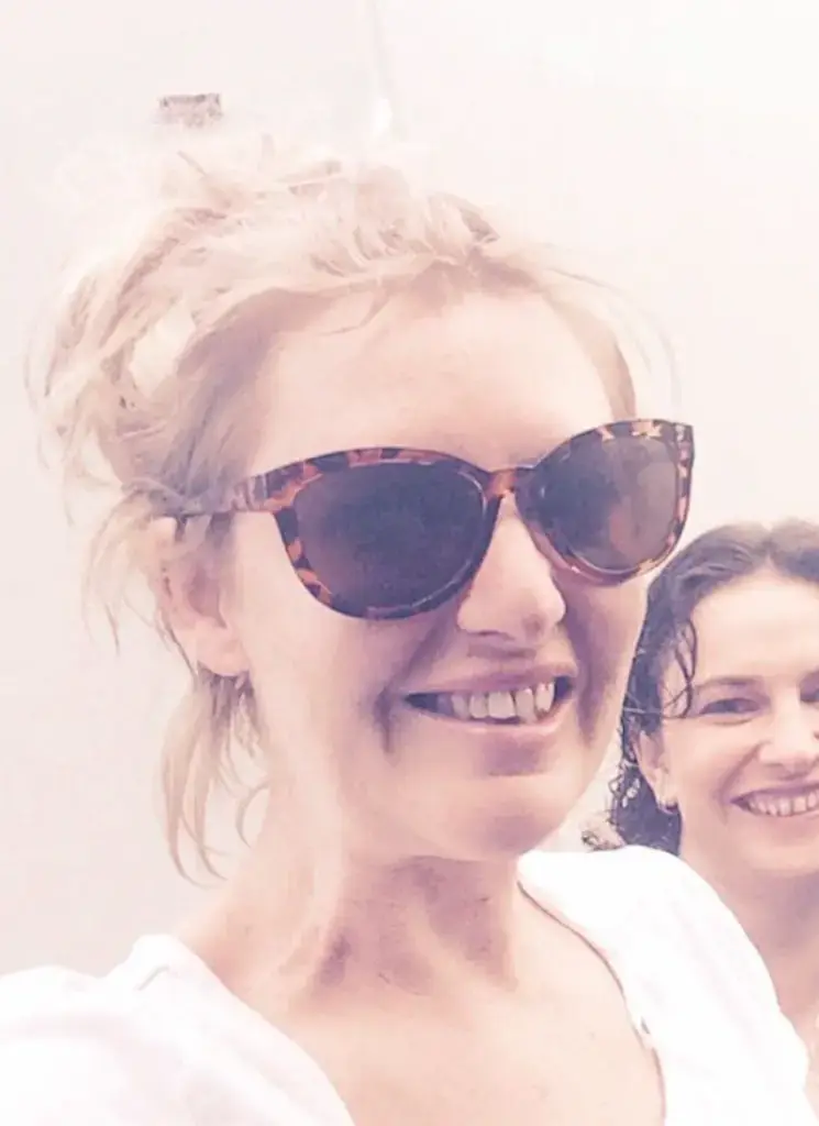 jess eva teeth 2015