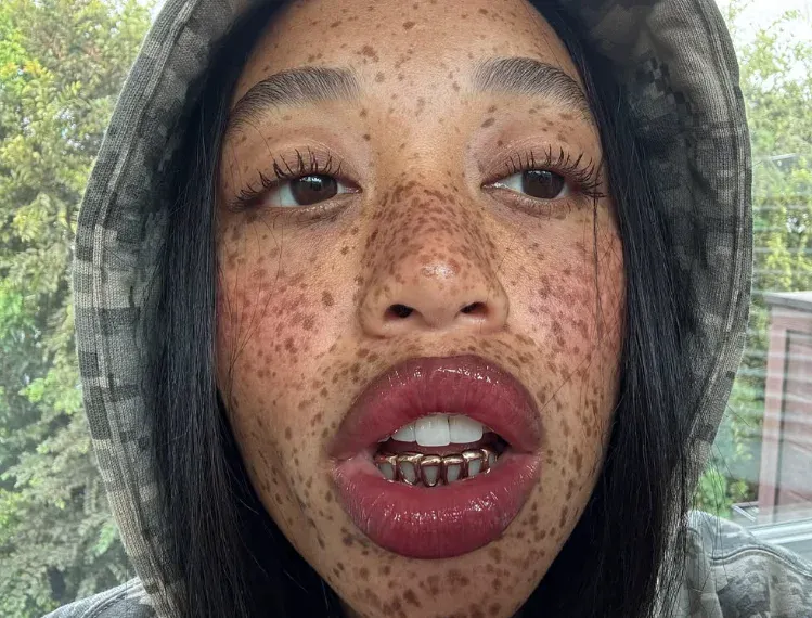 salem mitchell teeth in 2025