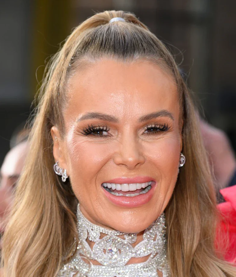 amanda holden teeth in 2025