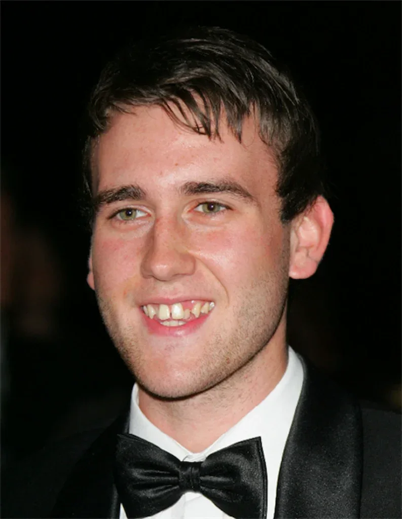 matthew lewis vorher