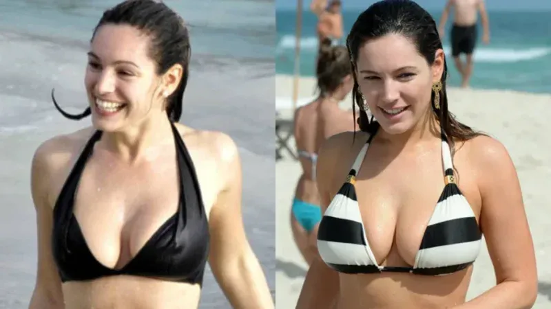 kelly brook before after