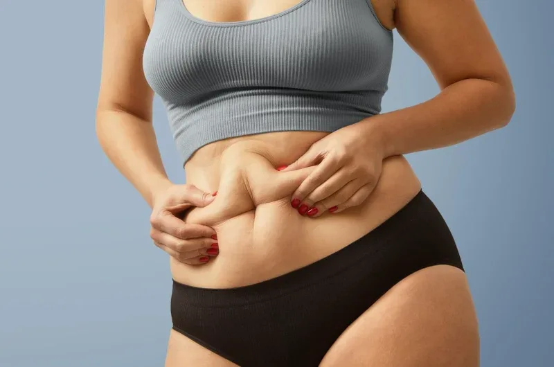 belly fat removal