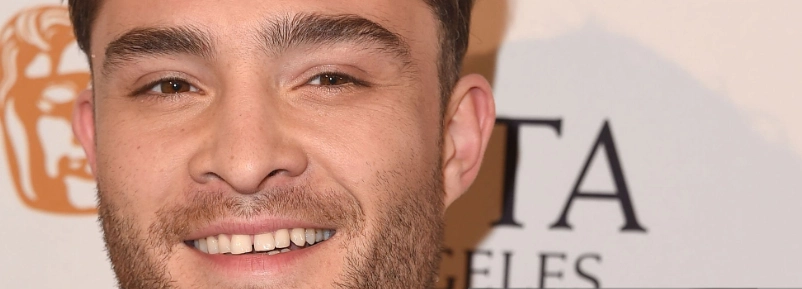 ed-westwick-teeth-in-2015