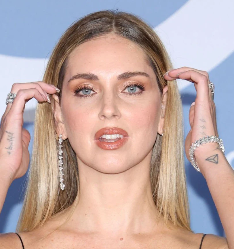 dinți chiara ferragni &icirc;n 2024