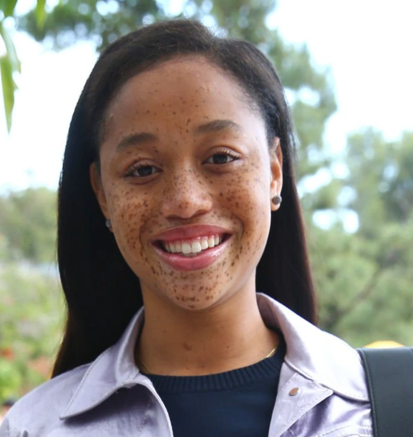 salem mitchell teeth in 2017