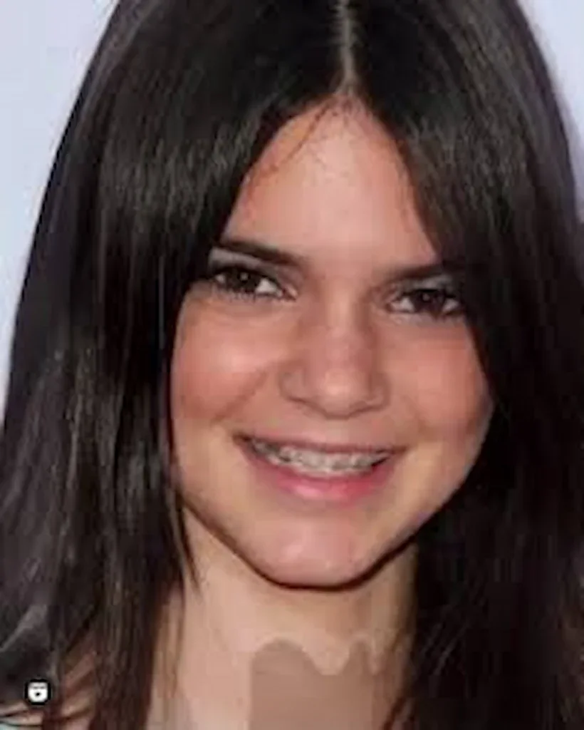 kendal jenner before