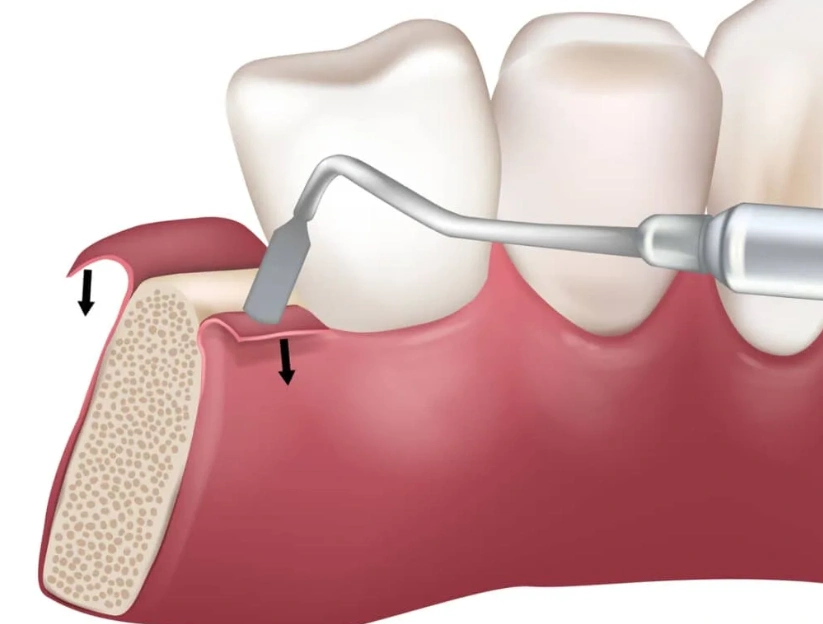 dental-code-d4266