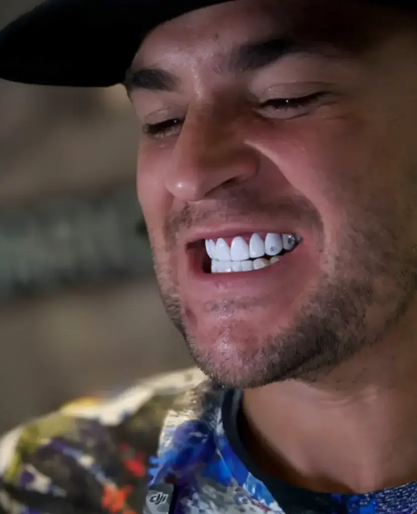 dusti poirier teeth 2025