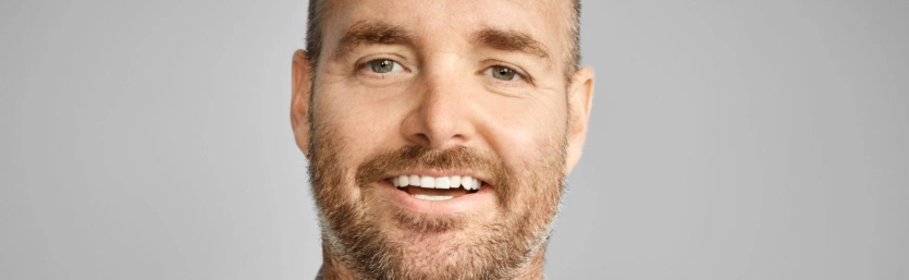zeby-will-forte-hollywood-smile