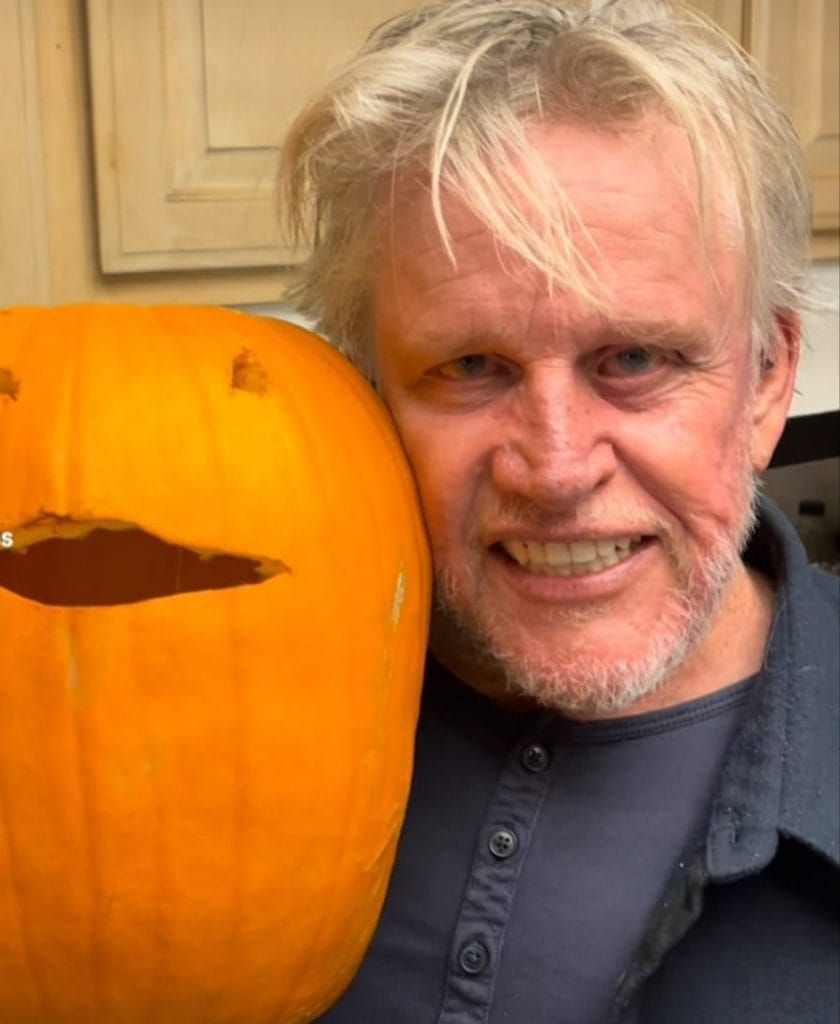 dientes de gary busey en 2025