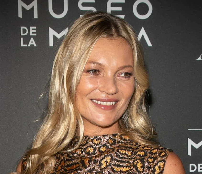 dientes de kate moss 2020