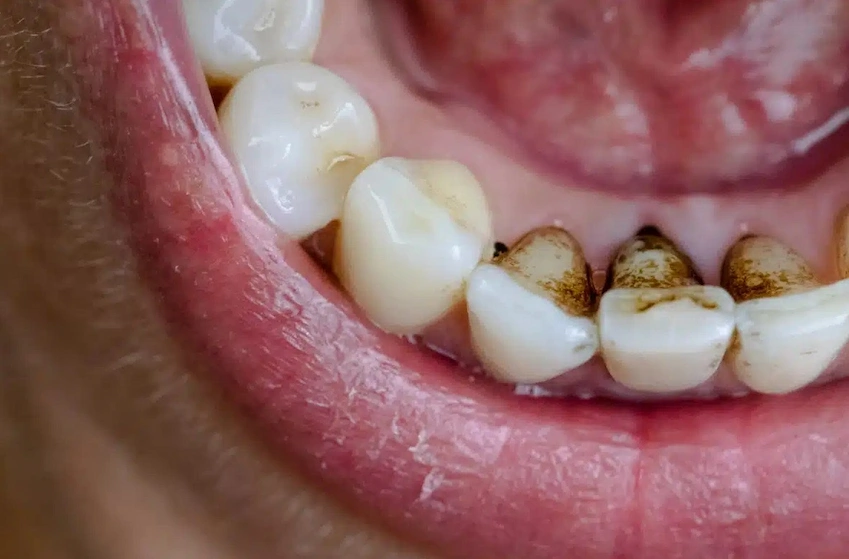 black stains