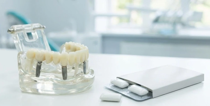 kan du tygge tyggegummi med all-on-4-implantat