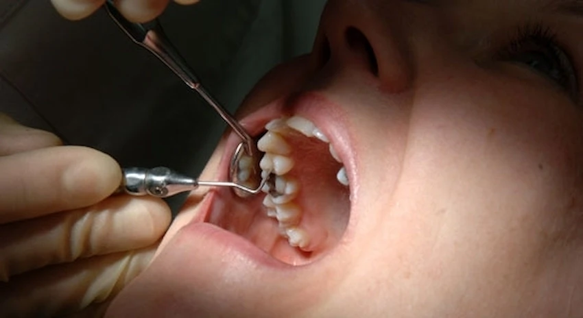denti-coltivati-in-laboratorio