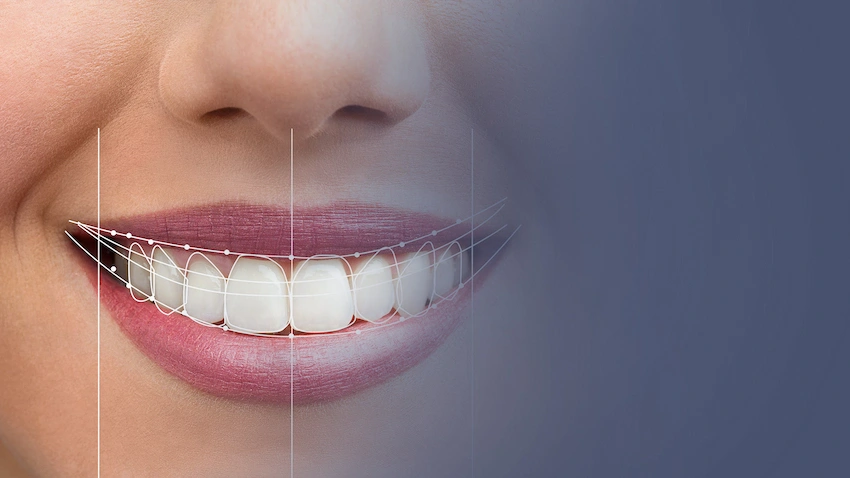 100% digital smile design