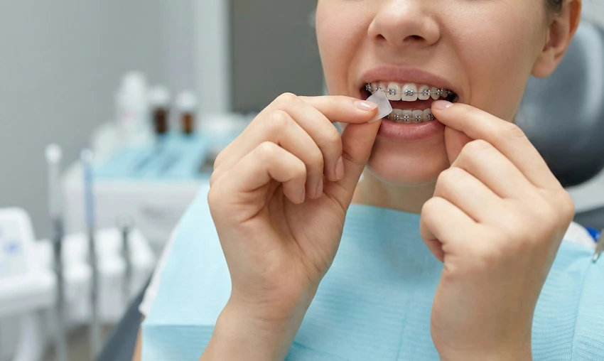ist dental wax sicher