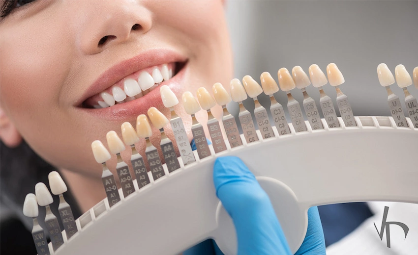 krone-dental-kode-d7952