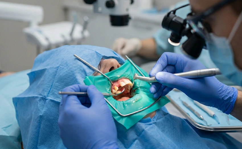 chirurgie apicoectomie instrumente microsurgicale clinică dentară