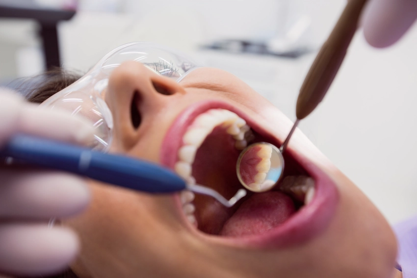 d2392-dental-code