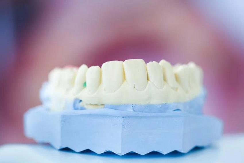 how long after extractions can you use denture adhesive