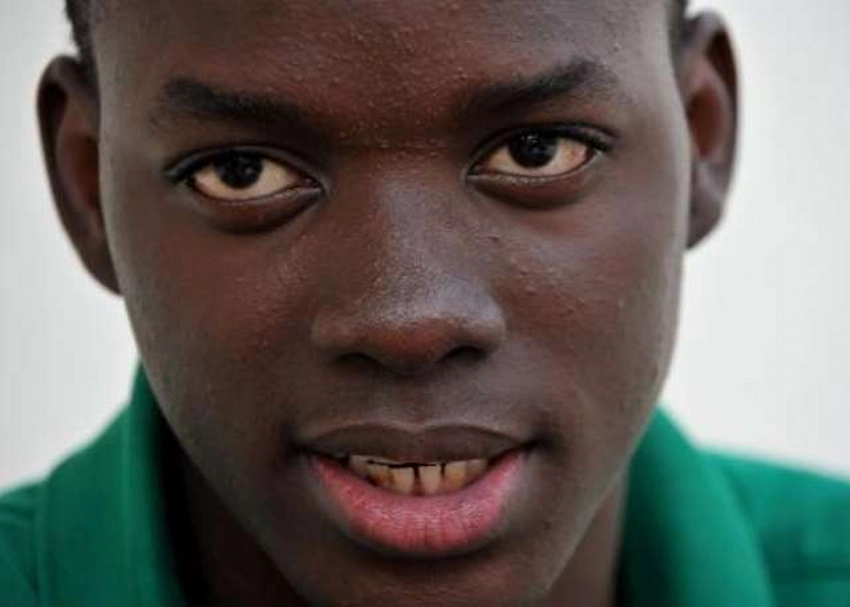 dinți Bertrand Traor&eacute; 2012