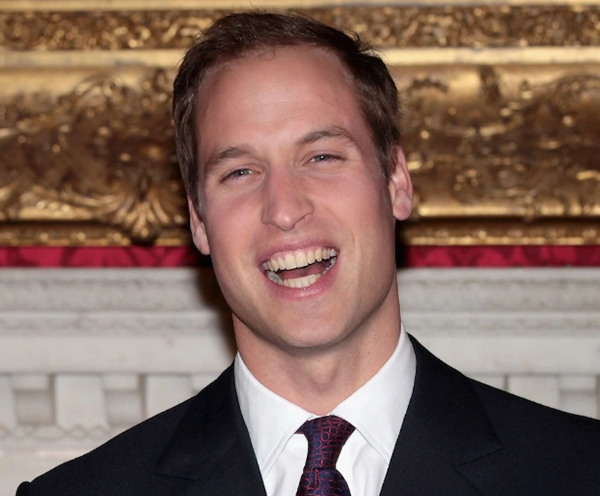 prince william teeth 2010