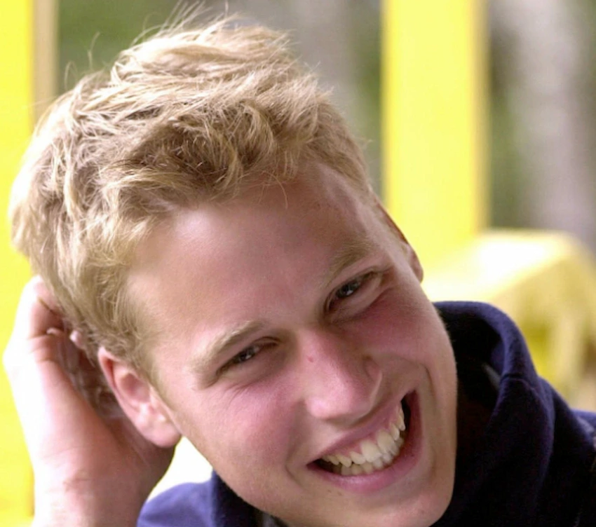 prince william teeth 2000