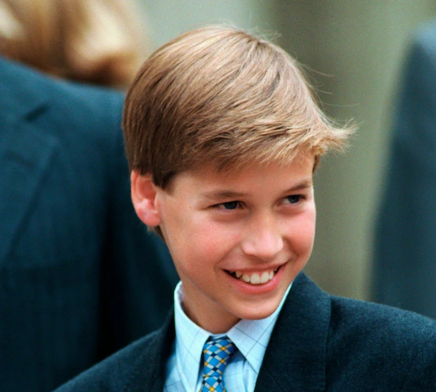 prince william teeth 1996