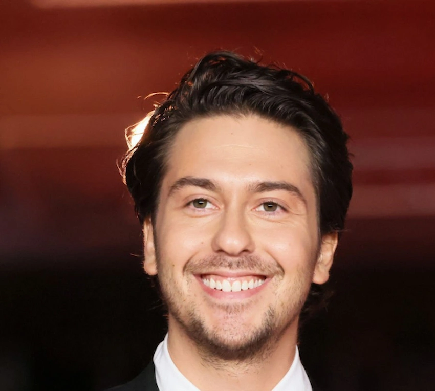 nat wolff teeth 2023