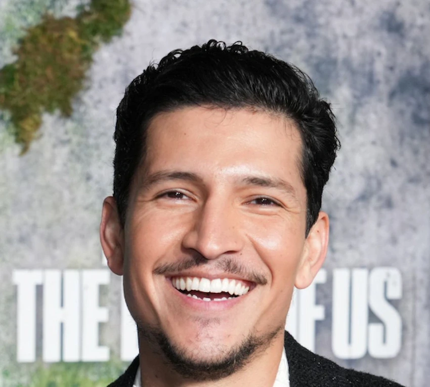 danny ramirez teeth 2025