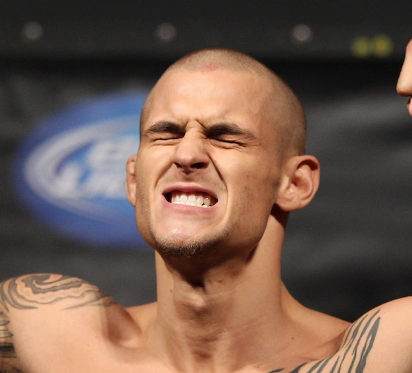 dustin poirier teeth 2012