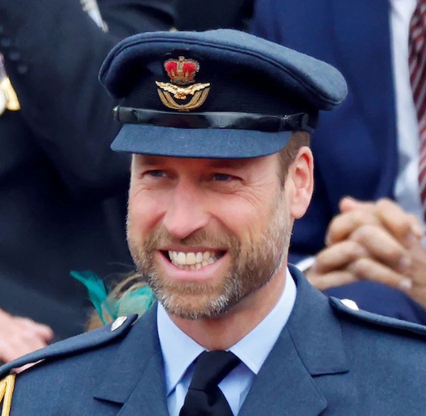 prince william teeth 2025