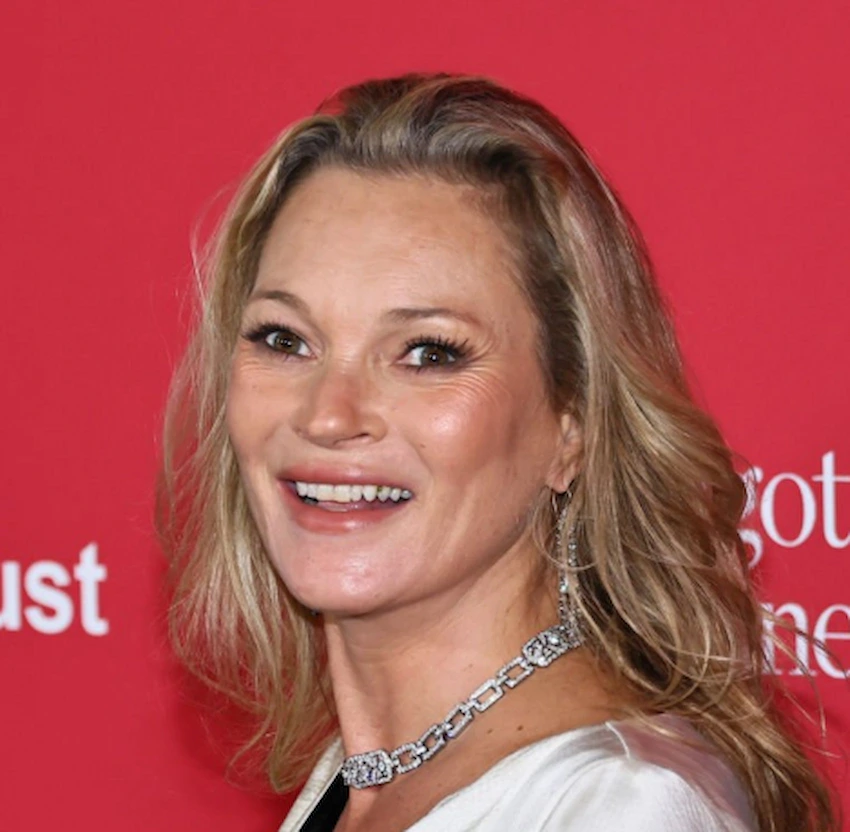 dientes de kate moss 2025