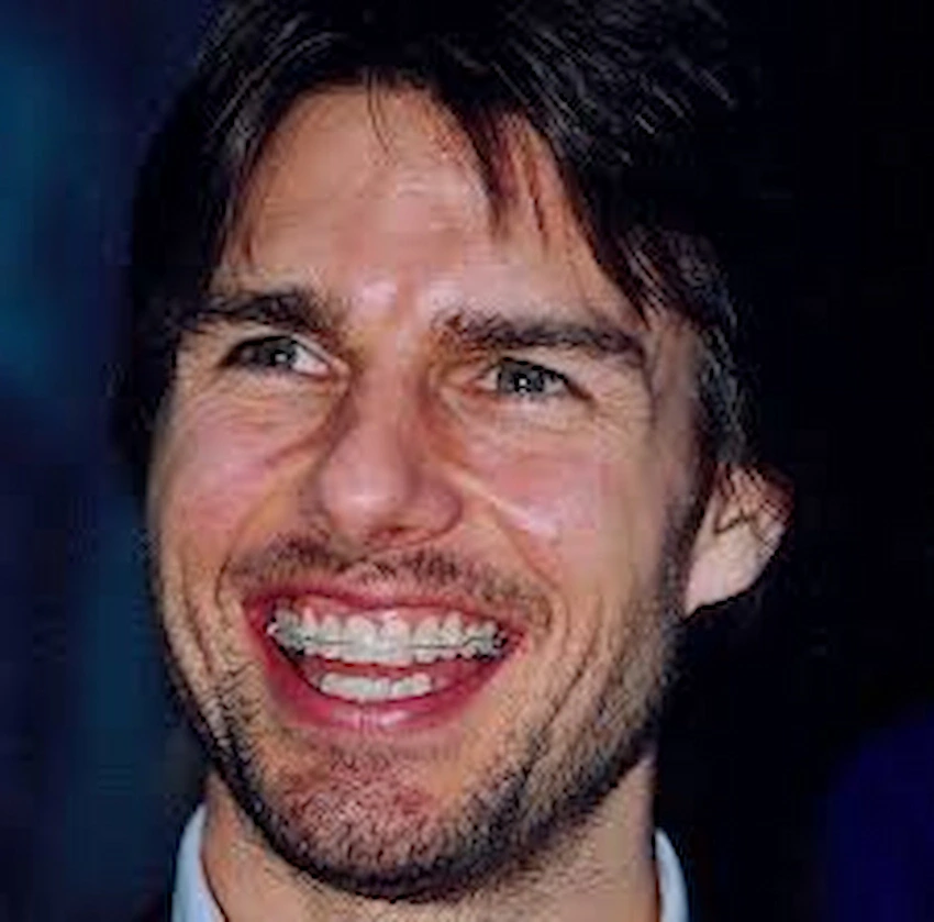 trattamento tom cruise