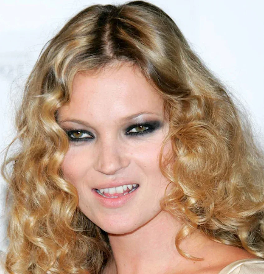 dientes de kate moss 2005