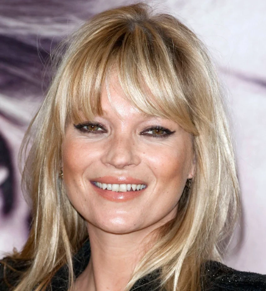 dientes de kate moss 2010