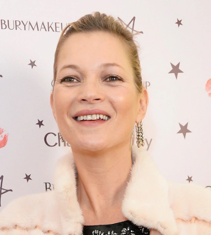 dientes de kate moss 2015
